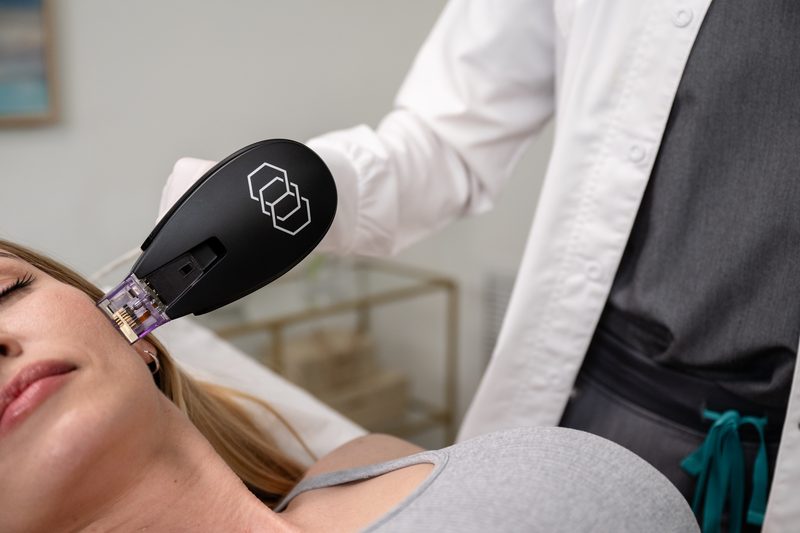 Morpheus8 RF microneedling handpiece being applied to a client's jawline by a SootheIV provider